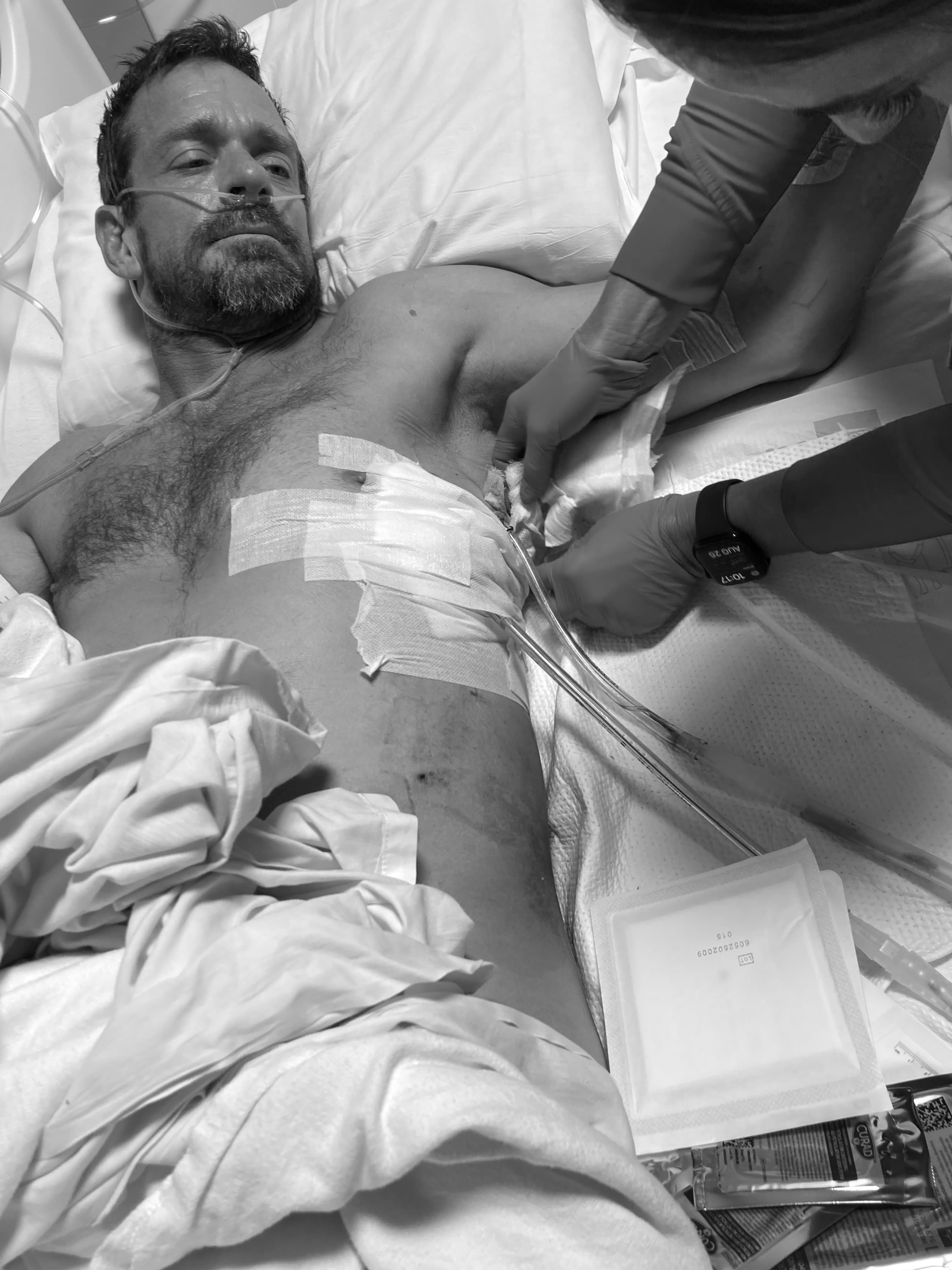 Medical tubes during Michael Cavett's hospital recovery